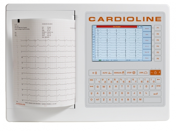 Elettrocardiografi 